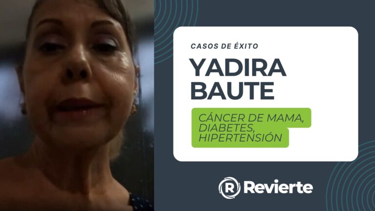 Yadira Baute